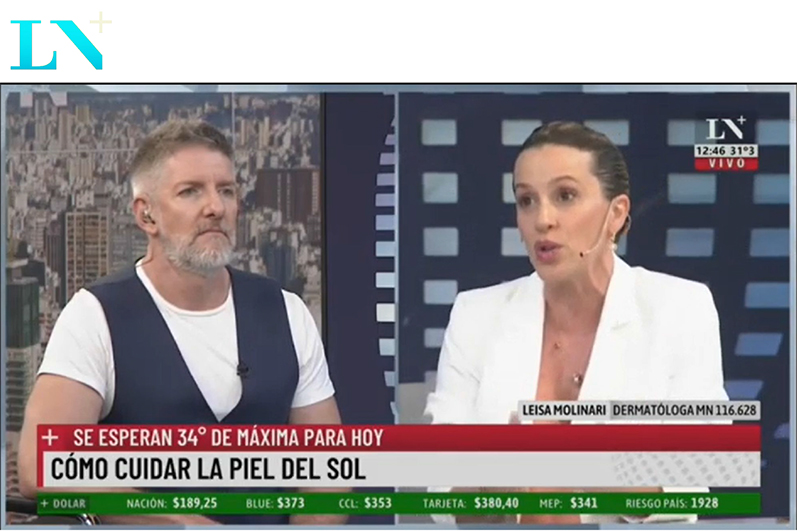 Buen día Nación: Cómo cuidar nuestra piel de los rayos del sol