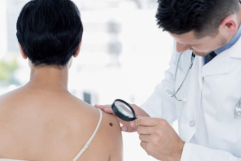 Tratamiento de Melanoma en Centro Médico de la Piel