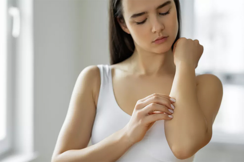 Psoriasis: abordaje y tratamiento efectivo