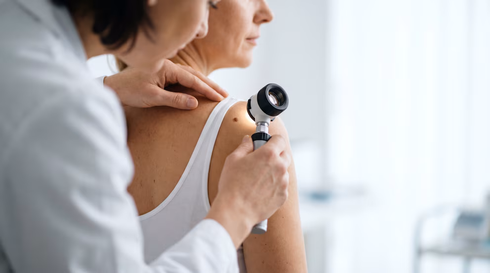 Dermatólogo examinando un lunar sospechoso con dermatoscopio