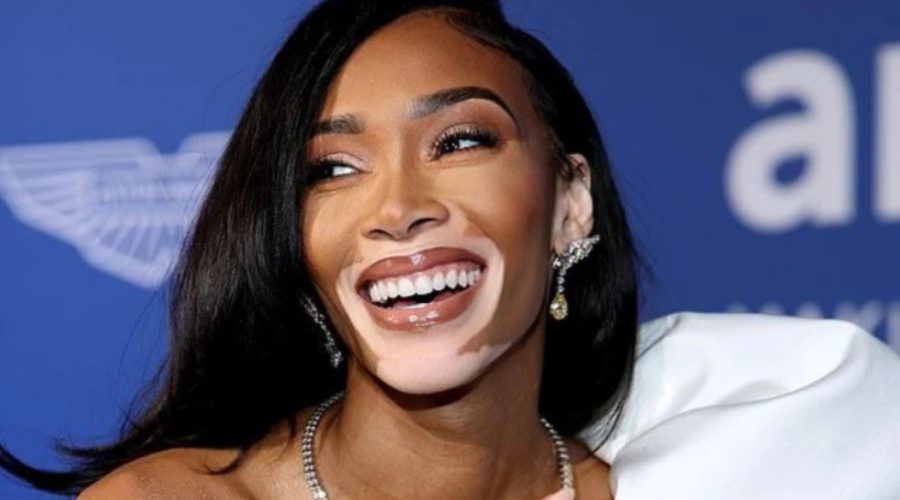 El vitiligo: por qué es una enfermedad y no una cuestión estética